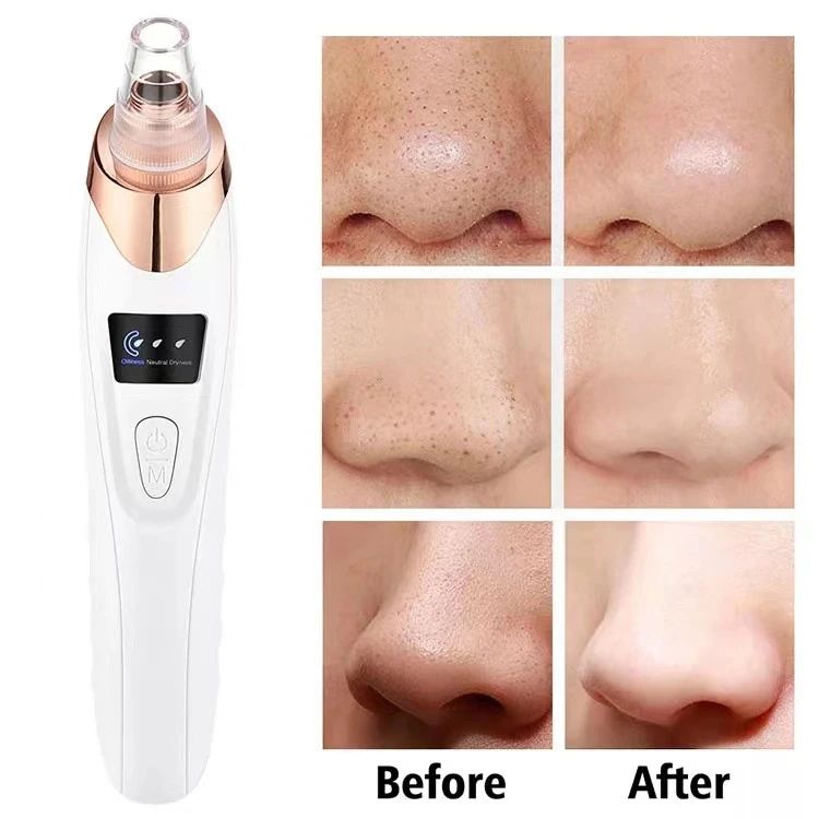 Blackhead Remover Vacuum Acne Cleaner Black Spots Removal